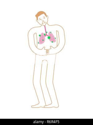 L'anatomie des poumons malades de la maladie humaine. L'organe interne malades. Les douleurs des virus et des bactéries. En difficulté personne Illustration de Vecteur