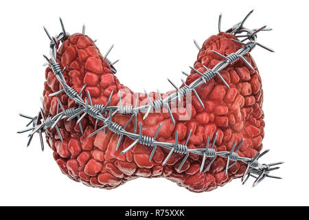 La thyroïde avec des barbelés. La maladie thyroïde concept. Le rendu 3D isolé sur fond blanc Banque D'Images