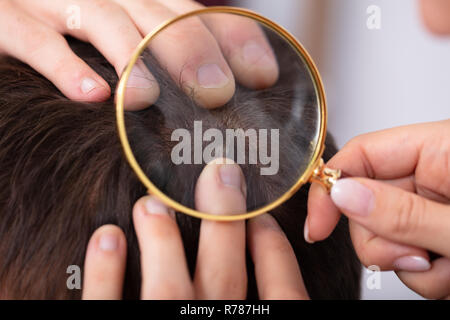 Close-up of a woman's Hand Examining Man's cheveux avec loupe Banque D'Images