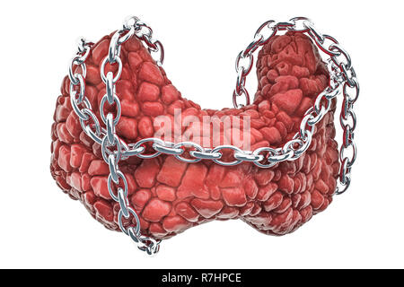 La maladie thyroïde concept. La thyroïde avec chaîne. Le rendu 3D isolé sur fond blanc Banque D'Images