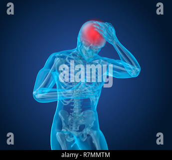 Attaque de la douleur, l'homme souffrant de douleur au cerveau. 3D illustration Banque D'Images