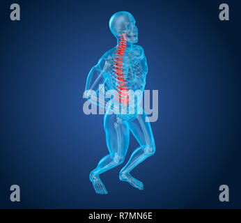 Attaque douleur rachidienne, l'homme souffrant de douleur rachidienne. 3D illustration Banque D'Images