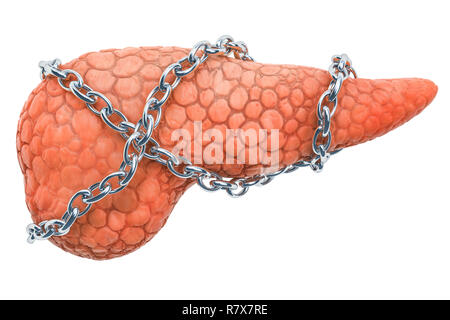 Le concept de maladie pancréatique. Les droits de l'pancréas avec chaîne. Le rendu 3D isolé sur fond blanc Banque D'Images