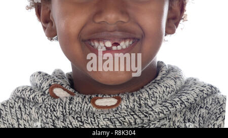 Enfant Africain montrant ses nouvelles dents isolé sur fond blanc Banque D'Images