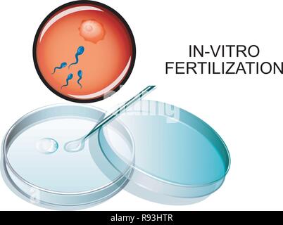 Illustration vecteur de la fertilisation in vitro. La FIV Illustration de Vecteur