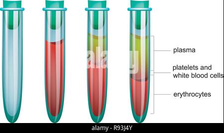 Vector illustration du sang in vitro, le plasma et les érythrocytes Illustration de Vecteur