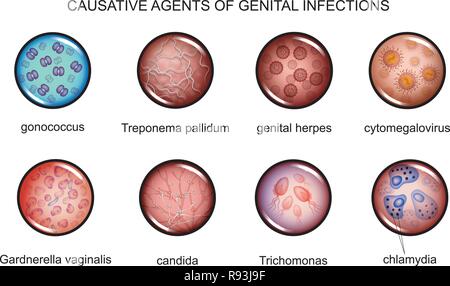 Illustration vecteur d'agents pathogènes des infections sexuellement transmissibles Illustration de Vecteur