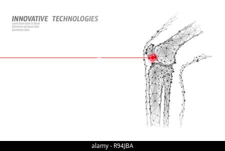 Les droits de l'articulation du genou modèle 3d vector illustration. La technologie de l'avenir design poly basse cure de traitement de la douleur. Fond blanc et rouge homme jambe blessures corps modèle médecine Illustration de Vecteur