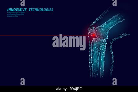 Les droits de l'articulation du genou modèle 3d vector illustration. La technologie de l'avenir design poly basse cure de traitement de la douleur. Fond bleu et rouge homme jambe blessures corps modèle médecine Illustration de Vecteur