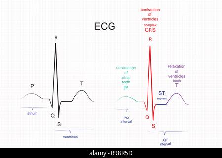 Illustration de l'interprétation de l'ECG. Une personne en bonne santé de l'ECG Illustration de Vecteur