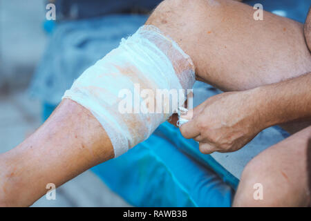 Processus d'application d'un bandage sur la jambe blessée, desmurgy Banque D'Images