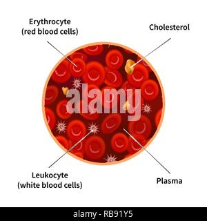 La composition du sang infographie avec les érythrocytes, les cellules de sang blanches, de cholestérol et de plasma isolated on white Illustration de Vecteur