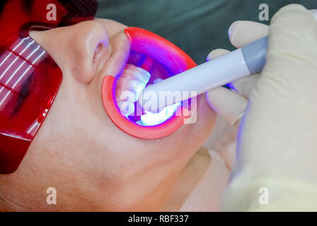 Patient avec des lunettes de sécurité et de l'enrouleur sur la joue. Lampe lumière laser activer comme une procédure de blanchiment des dents professionnels. Cosmétiques et esthétiques des femmes Santé Soins dentaires Blanchiment des dents saines.Concept intérieur. Banque D'Images