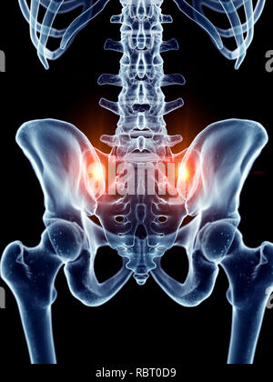 Illustration du sacrum douloureux des articulations. Banque D'Images