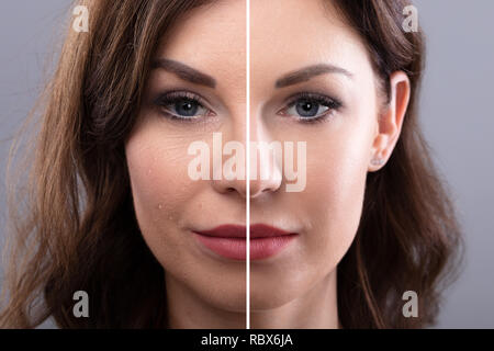 Portrait Of A young woman's Face avant et après intervention cosmétique Banque D'Images