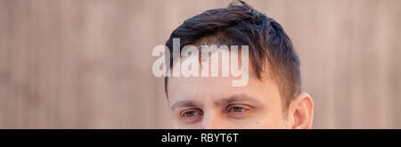 Blessure au crâne avec Suture, fils de couture craniectomy postopératoire avec beaucoup d'agrafes, de la technologie médicale la couture. Banque D'Images