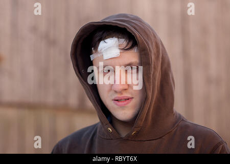 Blessure au crâne avec Suture, fils de couture craniectomy postopératoire avec beaucoup d'agrafes, de la technologie médicale la couture. Banque D'Images