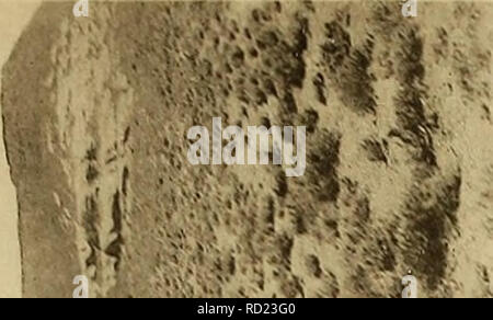 . Denkschriften - Österreichische Akademie der Wissenschaften. Kober, L, : Geologische Forschungen dans Vorderasien. II. Teil. Taf III.. 1^^ vi- , CM. Veuillez noter que ces images sont extraites de la page numérisée des images qui peuvent avoir été retouchées numériquement pour plus de lisibilité - coloration et l'aspect de ces illustrations ne peut pas parfaitement ressembler à l'œuvre originale.. Akademie der Wissenschaften in Wien. Mathematisch-Naturwissenschaftliche Klasse. Paris, New York, Springer Banque D'Images