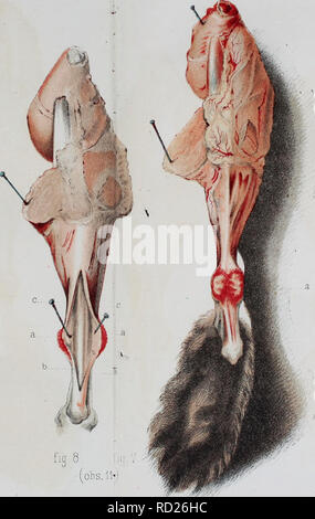 . De la régéneration des organes et des tissus. La régénération de l'environnement ; la régénération (biologie).  %6.  %7. obs. 11. Veuillez noter que ces images sont extraites de la page numérisée des images qui peuvent avoir été retouchées numériquement pour plus de lisibilité - coloration et l'aspect de ces illustrations ne peut pas parfaitement ressembler à l'œuvre originale.. Demarquay, J. N. (Jean Nicolas), 1811-1875. Paris : J. B. Baillière et fils Banque D'Images