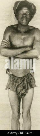 . Dans la grande forêt de l'Afrique centrale. Mon voyage au Congo et à la Mongala en 1896. La botanique. PI. 40.. ) Indigène de Mondunga. 1.. Veuillez noter que ces images sont extraites de la page numérisée des images qui peuvent avoir été retouchées numériquement pour plus de lisibilité - coloration et l'aspect de ces illustrations ne peut pas parfaitement ressembler à l'œuvre originale.. Thonner, Franz, 1863- ; L'Huillier, Henriette. Bruxelles : Société belge de librairie Banque D'Images