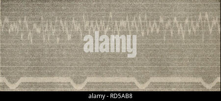 . Elektrophysiologie menschlicher Muskeln. L'électrophysiologie. Abb. 52. Temperatur 32". 50-52 Hauptwellen Sekunde pro.. Abb. 53. Temperatur 36". 55-58 Hauptwellen Sekunde pro.. Veuillez noter que ces images sont extraites de la page numérisée des images qui peuvent avoir été retouchées numériquement pour plus de lisibilité - coloration et l'aspect de ces illustrations ne peut pas parfaitement ressembler à l'œuvre originale.. Piper, Hans Edmund, 1877-. Berlin, J. Springer Banque D'Images