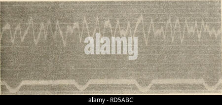. Elektrophysiologie menschlicher Muskeln. L'électrophysiologie. Abb. 49. Tempeiatur 20". 30 pro Hauptwellen Sekunde.. ,H. 50. Temperatur 24". 35 pro Hauptwellen Sekunde.. Veuillez noter que ces images sont extraites de la page numérisée des images qui peuvent avoir été retouchées numériquement pour plus de lisibilité - coloration et l'aspect de ces illustrations ne peut pas parfaitement ressembler à l'œuvre originale.. Piper, Hans Edmund, 1877-. Berlin, J. Springer Banque D'Images