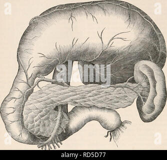 . La cyclopaedia d'anatomie et physiologie. Anatomie ; physiologie ; Zoologie. 82 PANCRÉAS. entièrement disséqué, il présente les cardinaux par exemple, le sillon longitudinal occupé et dépressions correspondant à eux, comme, par la veine splénique et gorge profonde à la Fig. 51.. Les pancréas, sliou-n in situ par vomir le suliject où la courbure de la tête du puits particulièrement illustré. qui l'artère mésentérique supérieure et la veine portae sont reçus. En face c'est en rapport avec la face postérieure de l'estomac, qui repose sur elle à vide (tanquam pulvinar, Scemm.), et Banque D'Images
