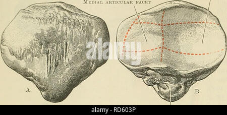 . Cunningham's Text-book de l'anatomie. L'anatomie. 246 l'ostéologie. Facette articulaire latéral. habituellement avion, ou quelque peu convexe transversalement. Parfois, dans la macération de l'os, les indices d'une troisième zone verticale sont à noter le long du bord médial de l'aspect postérieur. Ceci définit la partie de la surface articulaire qui repose sur la frontière latérale de la face interne en flexion extrême condyle. Dans l'état récemment, lorsque la fémorale sur- face est recouverte d'un cartilage, plus arraDgement com- plexes de facettes peut être, dans certains cas, affiche (comme en- dicated en Fig. 244). Lamont {Anat. et Banque D'Images