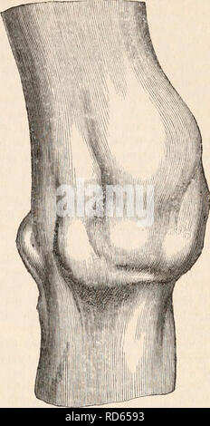 . La cyclopaedia d'anatomie et physiologie. Anatomie ; physiologie ; Zoologie. Genou gauche, vue de face. Le gonflement proéminent sur la gauche, une, est de l'en- laryed la tête du tibia ; celle de droite, B, est le gonflement globuleux doux résultant de l'effusion dans la membrane synoviale. p. et projection de l'intérieur de la marge du condyle tibia : il se penche sur la face interne du muscle ischio-jambiers. Le reste de l'espace poplité sents avant une apparence normale. Lorsque le membre est en extension complète, et les muscles sont autorisés à rester dans un état passif, la rotule peut être déplacé d'un côté à l'autre avec le MUC Banque D'Images