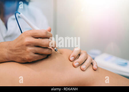 Aiguille aiguille sèche Electroacupunture raccordement de la machine à des aiguilles utilisées par acupunturist sur patient pour l'acupunture guidée par Intratissue Percutane EPI Banque D'Images