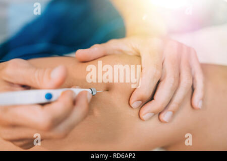 Aiguille aiguille sèche Electroacupunture raccordement de la machine à des aiguilles utilisées par acupunturist sur patient pour l'acupunture guidée par Intratissue Percutane EPI Banque D'Images