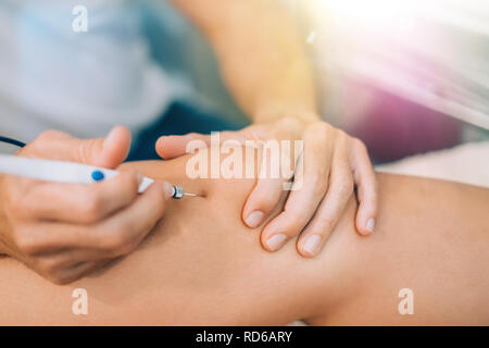 Aiguille aiguille sèche Electroacupunture raccordement de la machine à des aiguilles utilisées par acupunturist sur patient pour l'acupunture guidée par Intratissue Percutane EPI Banque D'Images