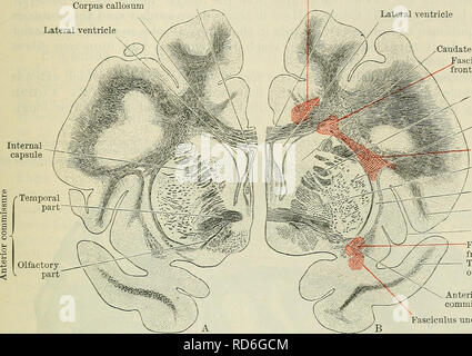 . Cunningham's Text-book de l'anatomie. L'anatomie. Le LIVRE BLANC DE L'CEEEBEAL HEMISPHEEES MATTEE. 649 districts de cortex gris qui peuvent être très éloignées les unes des autres. Le plus connu de ces faisceaux sont les suivants : (1) l'uncinate forfait ; (2) le cingulum ; (3) l'ensemble longitudinal supérieur ; (4) l'inférieur ; et longitudinales (5) l'occipito-frontale. Le fasciculus uncinatus est composé de fibres qui voûte au-dessus de la tige de l'iCavumsepti j'pellucide Cingulum callosum de corpus callosum de corpus ventricule latéral ventricule latéral. Le noyau caudé occipito- asciculus frontalis [en] supérieure Banque D'Images