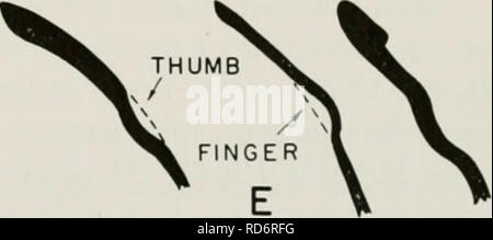 . Chronologie culturelle et le changement comme reflété dans la céramique de la vallée de Virú, Pérou. Poterie -- La vallée de Viru, Pérou ; Mounds -- Pérou Vallée Viru Viru ; Vallée, Pérou -- antiquités. Fig. 68. Tesson et tessons adulte. A-C, d'un zonage Guanape rouge ; D et E, Giu iiape modélisés. X 0,4. Jo Relations Type : Ce type est si semblable à l'ware noir poli du début de l'Ancon (Willey et Corbett, 1954, p. 53) qu'il a été désigné par le même nom. Il est également similaire à la poterie noire polie de Cupisnique (Larco Hoyle, 1941). La collection ROUGE ZONÉE GUANAPE ne contenait que 10 tessons de ce type Banque D'Images