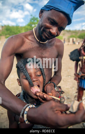 Himba démontrant comment ils enlèvent les dents du bas de l'enfant - Damaraland, Namibie, Afrique Banque D'Images