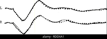 . Effets du traitement phonétique et sur la pertinence de stimulation de la réponse évoquée auditive.. Cerveau ; potentiels évoqués (électrophysiologie). Cv de stimulation pertinentes. b. L. CV CV. C. L. Veuillez noter que ces images sont extraites de la page numérisée des images qui peuvent avoir été retouchées numériquement pour plus de lisibilité - coloration et l'aspect de ces illustrations ne peut pas parfaitement ressembler à l'œuvre originale.. Silva, Dennis Alfred, 1948-. Banque D'Images