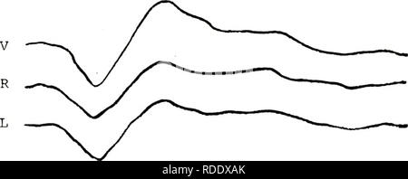 . Effets du traitement phonétique et sur la pertinence de stimulation de la réponse évoquée auditive.. Cerveau ; potentiels évoqués (électrophysiologie). Les 34 CV, stimulation. cv.. Veuillez noter que ces images sont extraites de la page numérisée des images qui peuvent avoir été retouchées numériquement pour plus de lisibilité - coloration et l'aspect de ces illustrations ne peut pas parfaitement ressembler à l'œuvre originale.. Silva, Dennis Alfred, 1948-. Banque D'Images