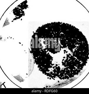 Nosema Maladie Les Abeilles Bui 780 U S Dept Of Agriculture Je Plaque I Photographies De Sections De L Estomac De L Abeille Comme Vu Par La Lame Microscopique Une Coupe Entiere De L Estomac Queen