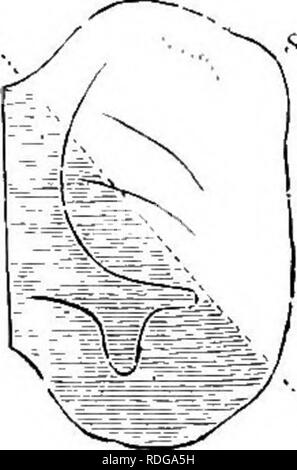 . Éléments de l'anatomie comparée des vertébrés. Anatomie, comparatif. 234 anatomie comparative conduit auditif externe. Ces éminences auriculaire s'unissent pour former un anneau continu près, sur -qui sont ensuite formé les protubérances caractéristique connue sous le nom de Helix, ft). ttiheli Ungiis nntitirajv), et j'.. Les variations de la forme de la pinna qui sont vus dans divers mammifères concernent essentiellement la partie formée plus tard quels projets vers le haut et vers l'arrière de la tête (Fiy. 188).. Veuillez noter que ces images sont extraites de la page numérisée des images qui peuvent avoir été retouchées numériquement pour Banque D'Images