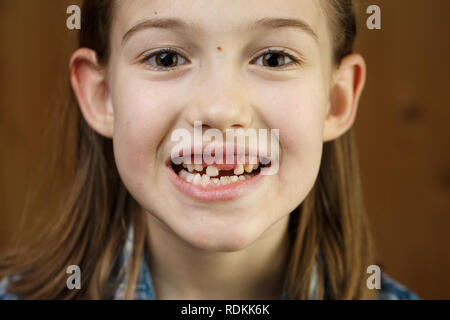 Little girl smiling, montrant ses dents de lait manquantes. La petite enfance joyeuse, ludique, fée des dents, la croissance et l'étape importante concept. Banque D'Images