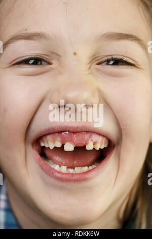 Little girl making faces, souriant, montrant ses dents de lait manquantes et lâche. La petite enfance joyeuse, ludique, fée des dents, la croissance et l'étape importante concept. Banque D'Images