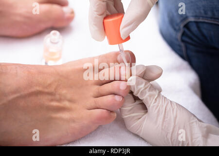 Close-up de manucure ongle main l'application de l'Huile Hydratante pour les pieds de l'Homme Banque D'Images