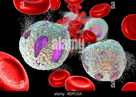 Concept de traitement de la leucémie aiguë lymphoblastique. Illustration d'ordinateur montrant la destruction des cellules lymphoblast. Banque D'Images