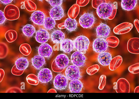 Concept de traitement de la leucémie aiguë lymphoblastique. Illustration d'ordinateur montrant la destruction des cellules lymphoblast. Banque D'Images