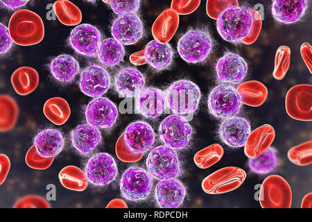 Concept de traitement de la leucémie aiguë lymphoblastique. Illustration d'ordinateur montrant la destruction des cellules lymphoblast. Banque D'Images