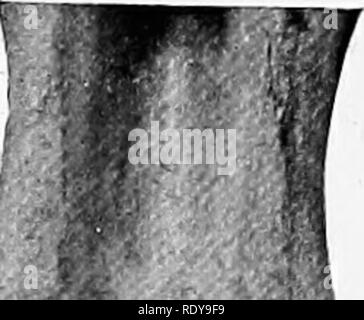 . L'anatomie de l'animaux domestiques . Anatomie vétérinaire. Fig. 338.-section longitudinale de la baisse d'Hohsb incisive. C, de la pâte de cavité. Le ciment est illustré dans le infundihulum, mais n'est pas marquée. Fig. 339.- -Échantillon de lc /, Infundihulum. ou dent de cheval, est située à la jonction de la prémaxillaire et le maxillaire ; la canine inférieure est plus près de l'angle incisive. Les canines sont des dents simples, plus petits que les incisives,. Veuillez noter que ces images sont extraites de la page numérisée des images qui peuvent avoir été retouchées numériquement pour plus de lisibilité - coloration et l'aspect de ces illustra Banque D'Images