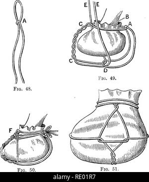 . Les maladies du pied du cheval . Sabots ; chevaux. OPEEATIONS SUR LE PIED rond 87 de la façon ordinaire, la boucle du cordon étant placé à l'arrière de l'métacarpe (comme dans A, fig. 49) ; les extrémités de la corde sont transmises, l'une ronde à l'intérieur et l'autre sur l'extérieur, vers l'avant (comme dans B, Fig. 49). Ces objectifs sont ensuite entrelacées ensemble vers le bas jusqu'à l'orteil (voir C de la Fig. 49). Le pied est maintenant levé, et les extrémités. Fig. 51. Fig. 48, 49, 50, 51.-Illdsteating Le Lieutenant-colonel Nunn's Méthode d'application de cataplasme au pied. de la corde (CO, fig. 49), sont passés par la boucle (comme un Banque D'Images