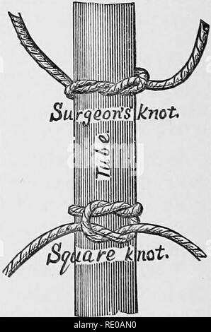 . La technologie appliquée à l'anatomie le chat domestique ; une introduction à usage humain et vétérinaire, et l'anatomie comparée. La dissection ; chats ; les mammifères. Fig. 40.-l'ASTD Incisions Prep- abation foe ligature ; X.5. et le tirer à travers. Bernard, A, 263. Lorsque le thread est aussi loin que vous le souhaitez, couper la boucle. Le fil le plus proche de l'incision est pour attacher la canule dans le navire ; l'autre est pour ligature le ves- sel lorsque l'injection est terminée. Les deux threads doit être liée de façon lâche dans une sur- geon^ Jcnot s (Fig. 41), afin qu'ils puissent rapidement être serré. § 358. Introduction de la canule.- Lorsque t Banque D'Images