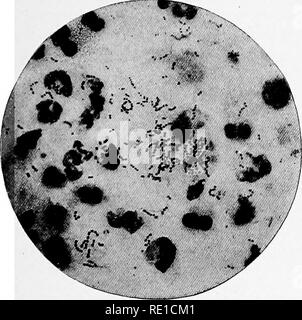 . Un texte-livre sur les protozoaires et les bactéries pathogènes pour les étudiants de médecine et les médecins. Bactériologie ; bactéries pathogènes ; les protozoaires. Streptococcus pyogenes est de 317 Staphylococcus citreus Passat.* Comme c'est pas commun et est dubitatif pathogène, il est de beaucoup moins d'importance que le pré- viously décrit les organismes. Streptococcus pyogenes (Rosenbach) Caractéristiques générales.-l'streptococcus est un non-motile, non-flagel- tard, non, non sporogènes se liquéfier, non-hybridation, aérobie et anaérobie facultatif, spheric, infections de l'organisme pour l'homme et la partie inférieure des animaux. Il se colore par Banque D'Images