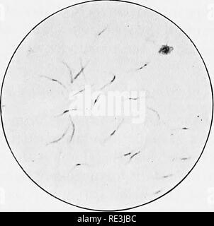 . En ce qui concerne les mouches aux maladies : sucent les mouches. Mouches mouches ; en tant que porteurs de la maladie ; Diptera. '^^1 CYCLE DE VIE DE PARASITE DU PALUDISME I35 et rester légèrement reliés ensemble au moyen de processus cytoplasmiques. Après la formation de la des sporoblastes une certaine quantité de protoplasme qui reste, contenant tous les déchets et aussi certains des granules pigmentaires initialement présent dans le macrogamete. Le noyau de chaque maintenant sporoblaste se divise en un grand nombre de plus petits ceux qui deviennent organisés autour de la périphérie. La surface de la puis sporoblaste cytoplasmique présente un certain nombre de p Banque D'Images